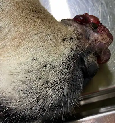 Tumor zona nasal
